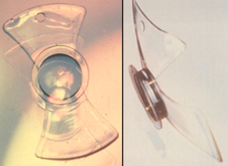 icrs-25-001f2.jpg